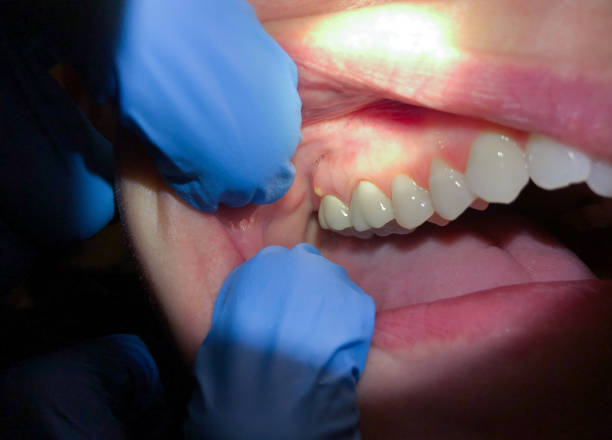 Professional Emergency Dental Service in GA